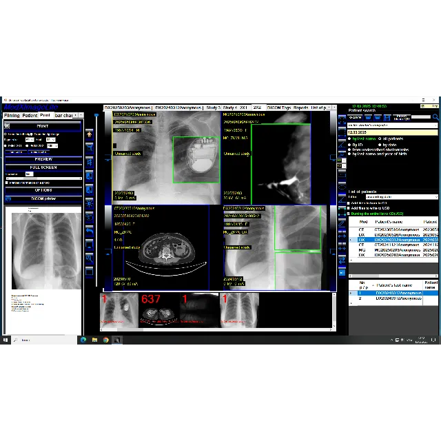 DICOM Рабочая станция врача-рентгенолога и лаборанта